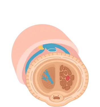 corpuri cavernoase înainte